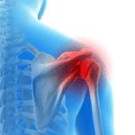 Baseball and Shoulder Injuries