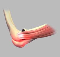 Elbow Sprain