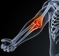 Elbow Pain