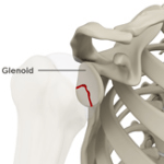 Glenoid Fractures