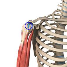 Long Head Biceps Tendon Rupture