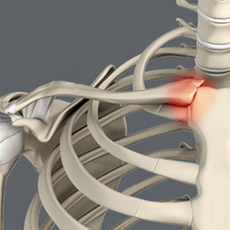 Sternoclavicular Joint (SC joint) Disorders