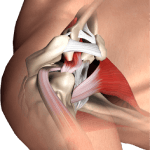 Subacromial Decompression